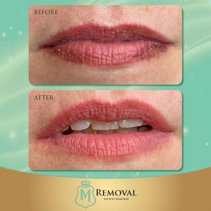 Ilgalaikio makiažo lektorė Ella Sakalauskienė: „Kai kurios meistrų klaidos yra labai pavojingos“